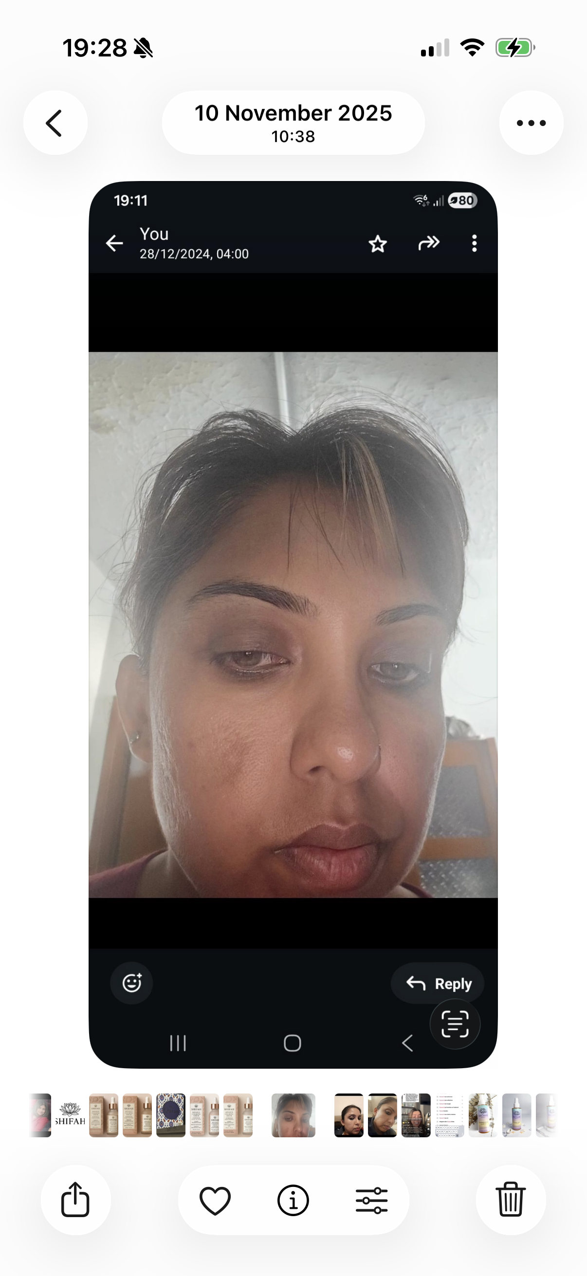 Melasma before and after: SHIFAH customer face with patchy pigmentation, then a more even tone