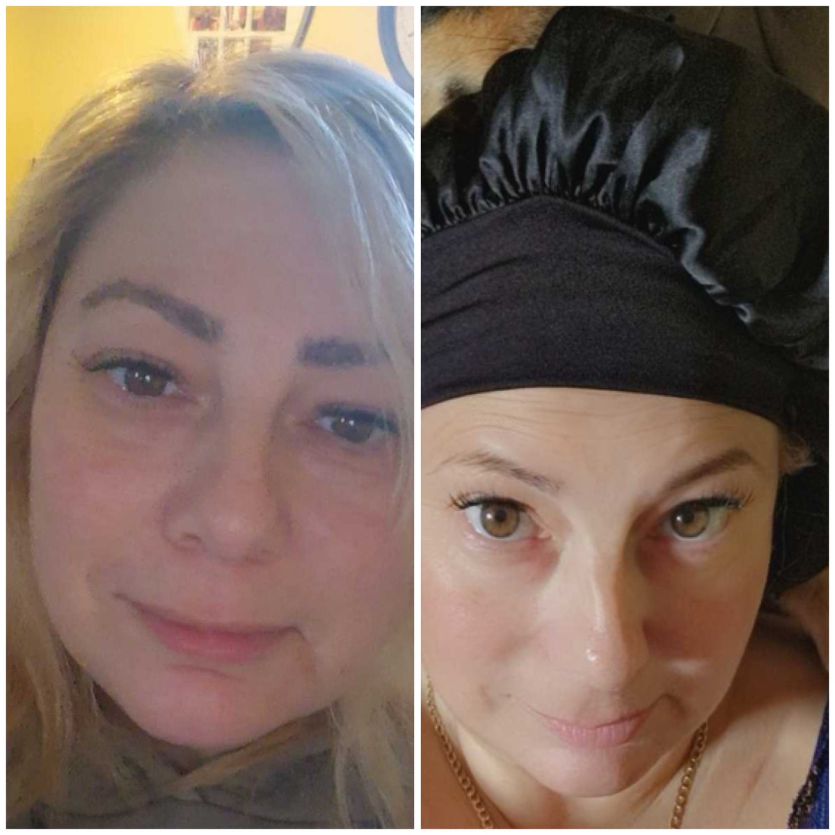 Skincare transformation: real SHIFAH customer face before and after