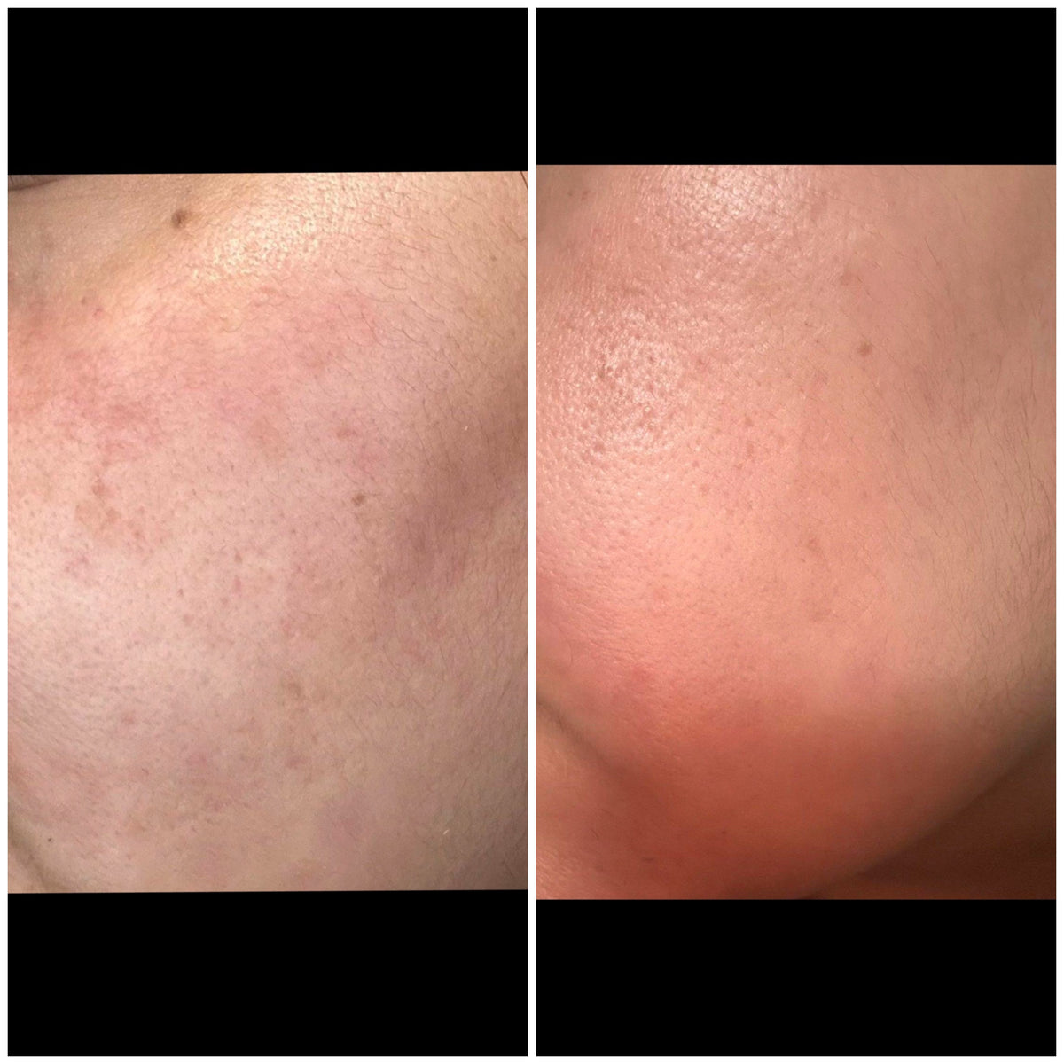 Skincare that works: real SHIFAH customer cheek with a more even tone